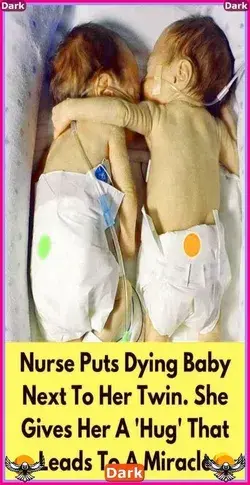Nurse Puts Dying Baby Next To Her Twin. She Gives Her A 'Hug' That Leads To A Miracle