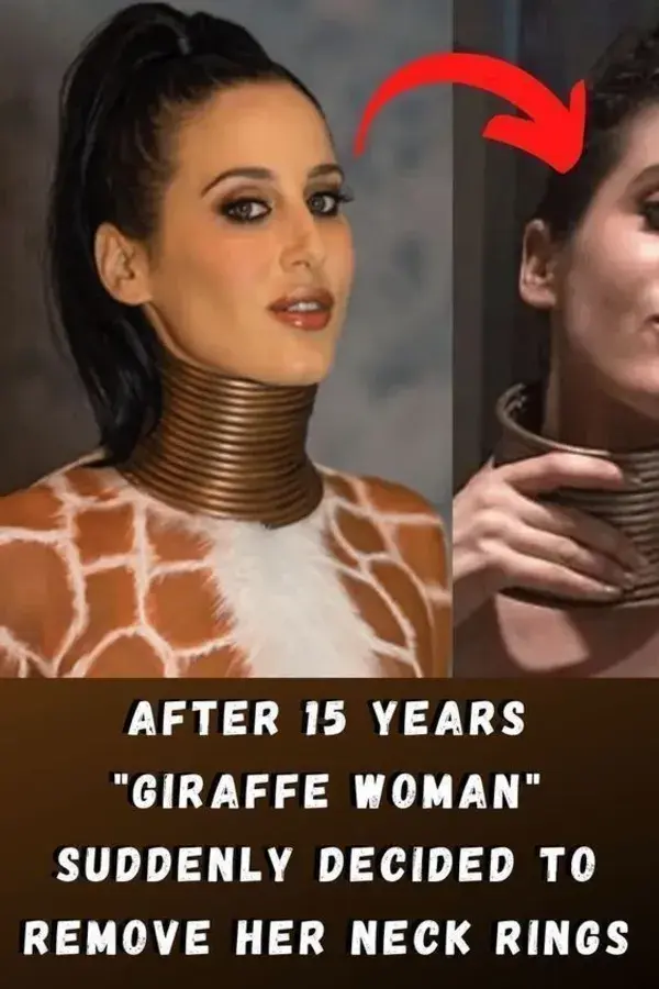 After 15 Years "Giraffe Woman" Suddenly Decided To Remove Her Neck Rings