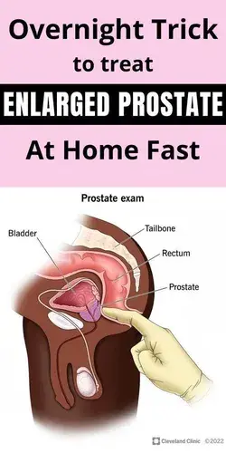 Overnight trick to treat enlarged prostate at home fast