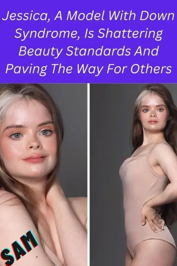 Jessica, A Model With Down Syndrome, Is Shattering Beauty Standards And Paving The Way For Others