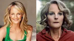 Helen Hunt’s Plastic Surgery: What Happened to The I See You Star’s Face?