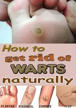 How To Get Rid Of Warts, Moles, Age Spots And Skin Tag Using Natural Remedies