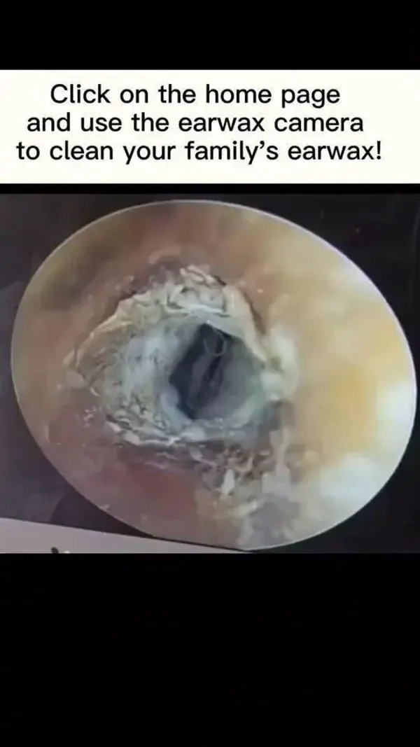 Ear wax removal