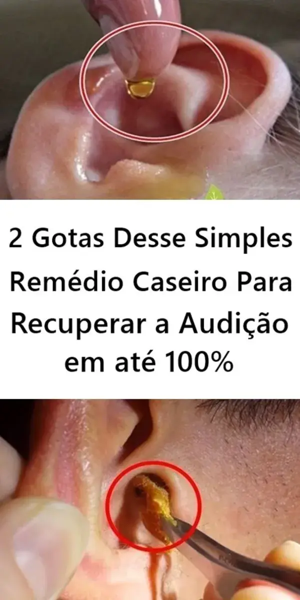 2 Gotas Desse Simples Remédio Caseiro Para Recuperar a Audição em até 100%