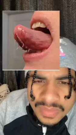 Have you ever seen spikes on the backside of a tongue?