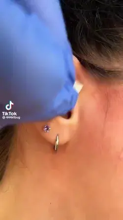 Ear Piercing