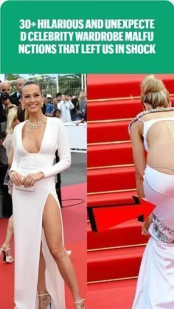 Hilarious And Unexpected Celebrity Wardrobe Malfunctions