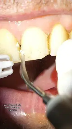 Fake food on fake teeth seems a bit gross