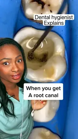 Dental hygienist  Explains root canal