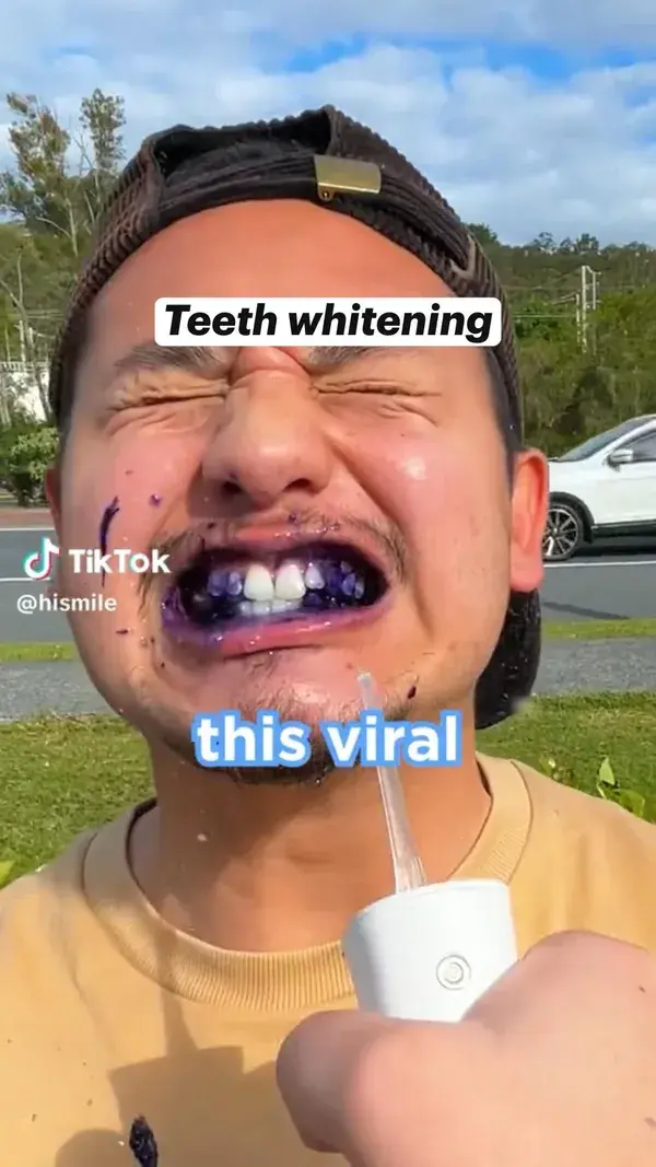 Teeth whitener (Click here)