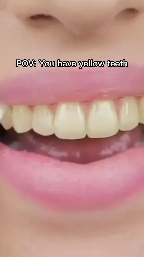 You have yellow teeth 🤮