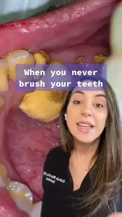 When You Never Brush Your Teeth