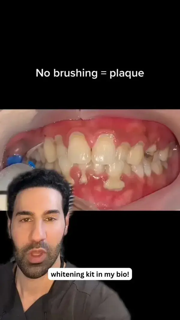 Reasons why you should brush your teeth