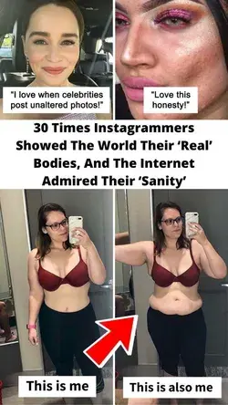 30 Times Instagrammers Showed The World Their ‘Real’ Bodies, And The Internet Admired Their ‘Sanity