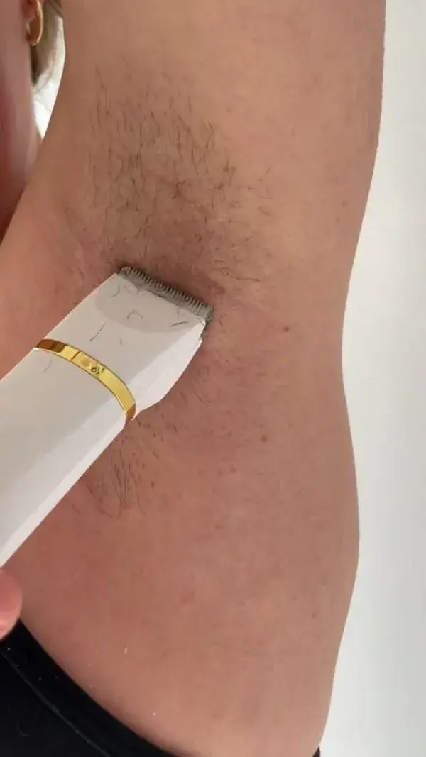 More Trimming, Less Ingrown Hairs 🙌