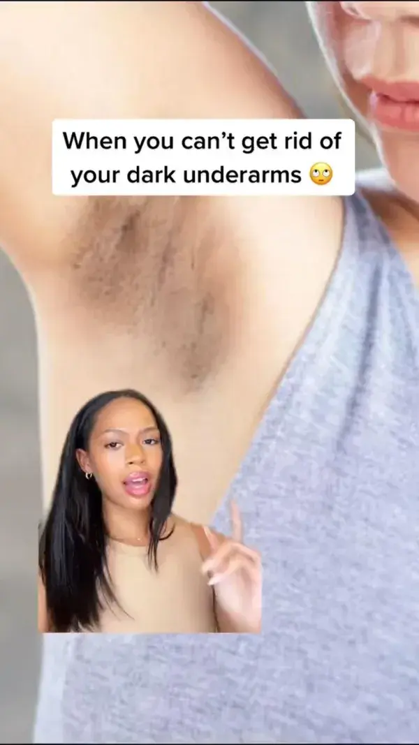 Get Rid of Your Dark Underarms