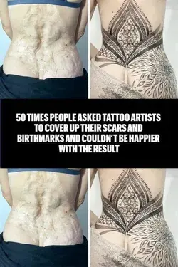 50 Times People Asked Tattoo Artists To Cover Up Their Scars And Birthmarks And Couldn’t Be