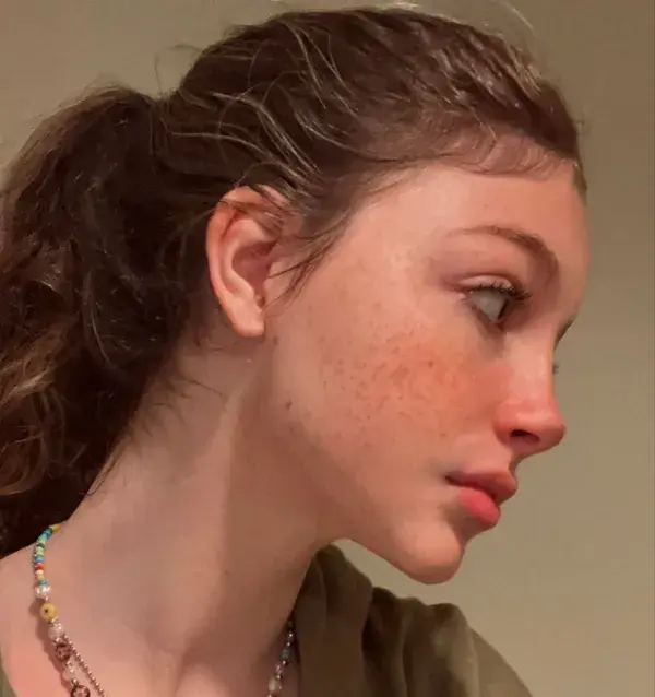 side profile ideal