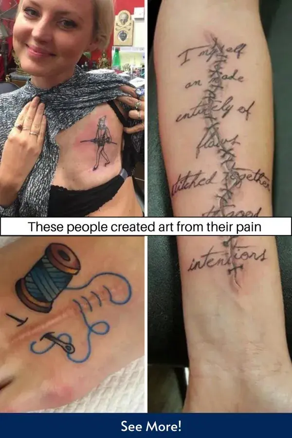 30 Tattoos Turn Scars Into Art That People Don’t Want to Hide Anymore