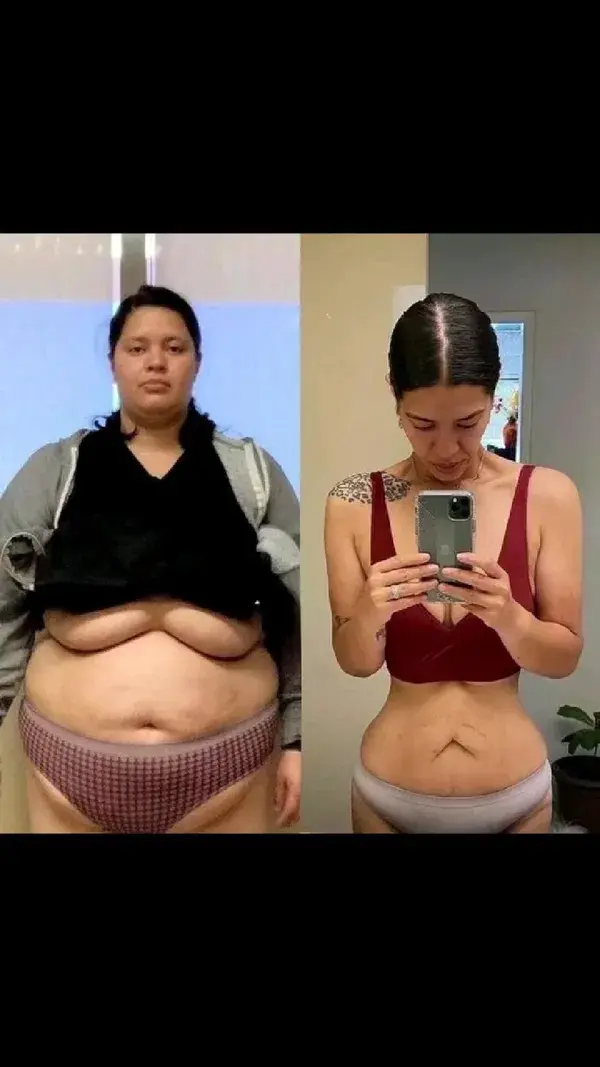 Insane Body Weight Loss Transformation 🤯