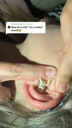 Blackheads Oddly satsfying