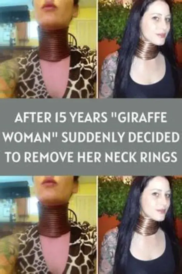 After 15 Years "Giraffe Woman" Suddenly Decided To Remove Her Neck Rings