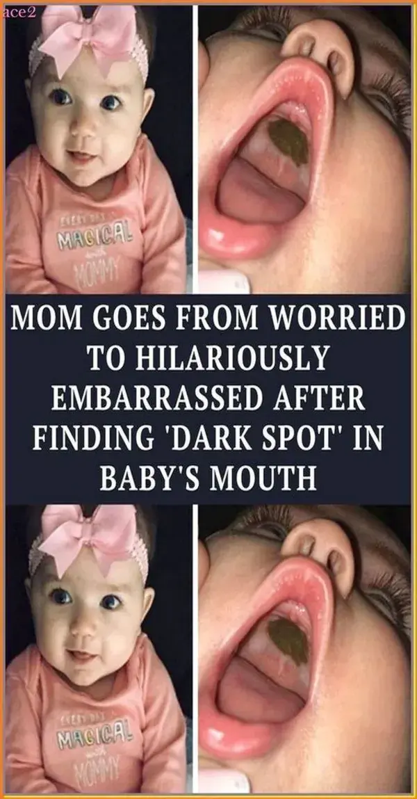 Mom goes from worried to hilariously embarrassed after finding 'dark spot' in baby's mouth