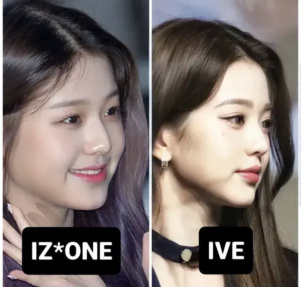 Surgery Wonyoung