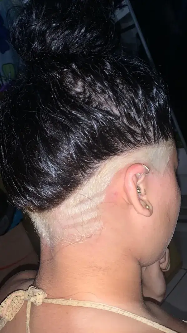 Undercut