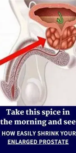 Take this spice in the morning and see how easily Shrink your Enlarged Prostate!