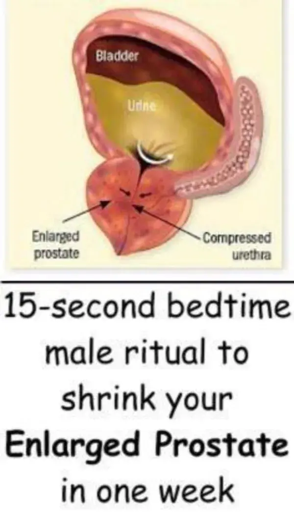 Prostate Health