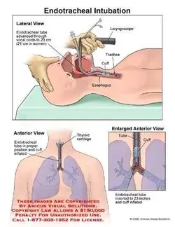 Medical Basics