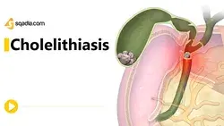 Cholelithiasis -II | Gastroenterology Animation