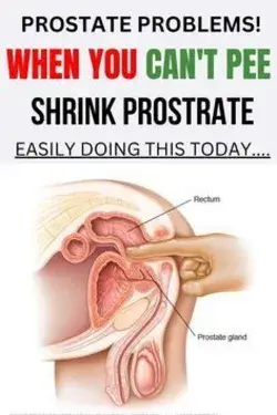 "Say Goodbye to Prostate Problems: Natural Remedies That Work"