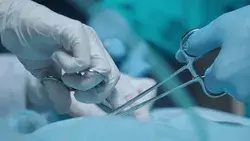 Surgery Operation. Close up of Stock Footage Video