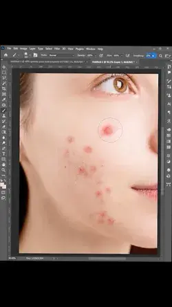 How to Remove Acne in Photoshop - Photoshop hacks