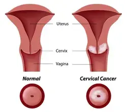 Dr Lal PathLabs Blog