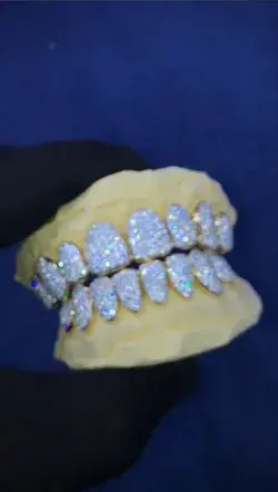 20% Off custom diamond grillz set