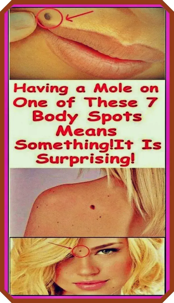 IF YOU HAVE A MOLE AT ONE OF THESE 7 PLACES ON YOUR BODY THIS IS WHAT IT MEANS!