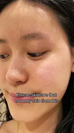 The best korean skincare