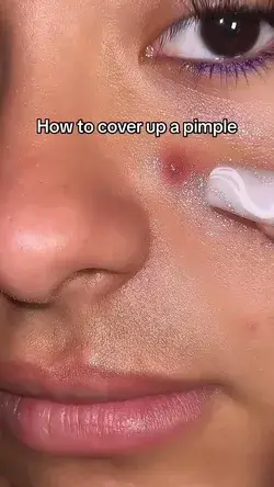 How to cover a pimple