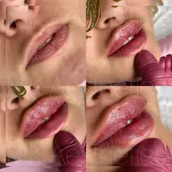 Russian Lips used 0,8ml