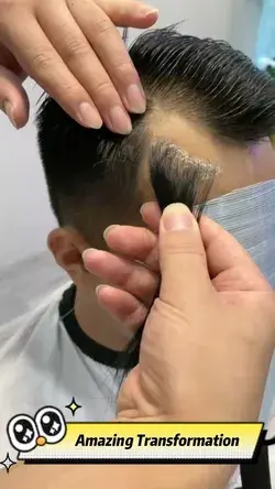 Hair Patch | Hair Replacement System - Perfect Solution to Male Hair Loss