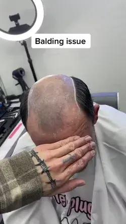 The whole process of wearing the Thin skin base hair system