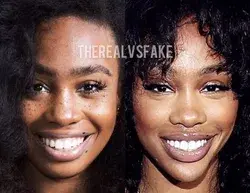 SZA: Chin Implant Surgery