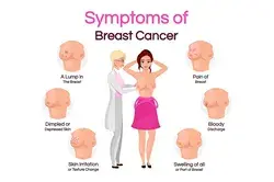 Breast cancer symptoms