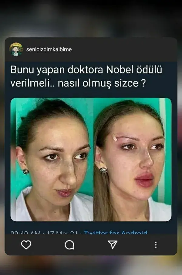 #Devrimgibievrim