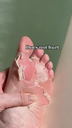 Insane peeling🤯 Plantifique Foot Peel Mask🔥 Incredible Results in just 7 Days🔥