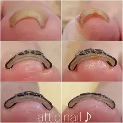 "Nail Growth SOS: Tried-and-True Tips for Rapid Results" How to Grow Nails Faster, Nail Growth Tips