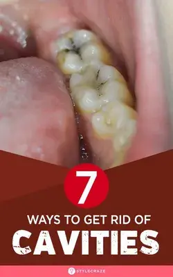 7 Home Remedies To Get Rid Of Cavities